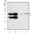 Western blot testing of 1) human HCCT, 2) human HCCP, 3) rat liver and 4) mouse liver tissue lysate with ORM1 antibody. Expected molecular weight: 24/41-60 kDa (unmodified/glycosylated).