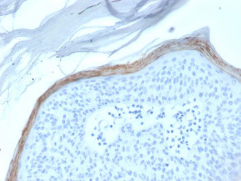 Kallikrein 5 Antibody Skin IHC. Immunohistochemistry analysis of FFPE human skin tissue stained with Kallikrein 5 Antibody demonstrates strong linear and cytoplasmic HRP-DAB brown staining within the superficial epidermal keratinocyte layers, consistent with KLK5-associated serine protease expression involved in epidermal barrier regulation and desquamation pathways.