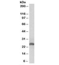 Western blot testing of human liver lysate with Apolipoprotein D antibody at 0.3ug/ml. Predicted molecular weight: ~21/21-33kDa (unmodified/glycosylated).