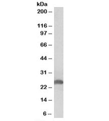 Western blot testing of human liver lysate with Apolipoprotein D antibody at 0.3ug/ml. Predicted molecular weight: ~21/21-33kDa (unmodified/glycosylated).
