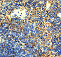 Immunohistochemical staining of ICAM1 using anti-ICAM1 antibody. ICAM1 was detected in a paraffin-embedded section of mouse spleen tissue. Heat mediated antigen retrieval was performed in EDTA buffer (pH 8.0, epitope retrieval solution). The tissue section was blocked with 10% goat serum. The tissue section was then incubated with 1:50 rabbit anti-ICAM1 antibody overnight at 4oC. Peroxidase Conjugated Goat Anti-rabbit IgG was used as secondary antibody and incubated for 30 min at 37oC.