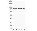 Western blot testing of FGFR4 antibody and Lane 1: HeLa; 2: PANC; 3: SGC; 4: COLO320; 5: SW620; Observed molecular weight: 88~125 kDa depending on phosphorylation and glycosylation level.
