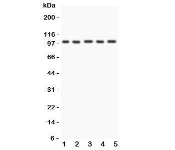 Western blot testing of FGFR4 antibody and Lane 1: HeLa; 2: PANC; 3: SGC; 4: COLO320; 5: SW620; Observed molecular weight: 88~125 kDa depending on phosphorylation and glycosylation level.