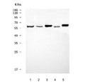 Western blot testing of 1) human SH-SY5Y, 2) human SiHa, 3) rat brain, 4) rat spleen and 5) mouse brain tissue lysate with GPR161 antibody. Predicted molecular weight ~59 kDa.