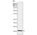 Western blot testing of human MCF7 cell lysate with TFF1 antibody. Predicted molecular weight ~12 kDa.