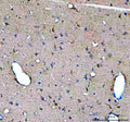IHC staining of FFPE rat brain tissue with GDNF antibody. HIER: boil tissue sections in pH8 EDTA for 20 min and allow to cool before testing.