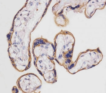 IHC testing of FFPE human placental tissue with SLC3A2 antibody. HIER: steam section in pH6 citrate buffer for 20 min and allow to cool prior to staining.