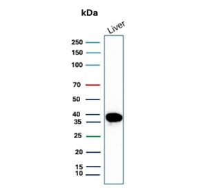 Western blot testing of human liver tissue lysate with Liver Arginase antibody (clone ARG1/9447). Predicted molecular weight ~35 kDa.