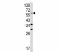 Western blot analysis of YAP antibody and NCI-H460 lysate. Predicted molecular weight ~54 kDa but routinely observed at 65-70 kDa.