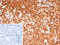 IHC staining of FFPE human spleen tissue with HSP90AA1 antibody (clone HSP90AA1/7426). Inset: PBS used in place of primary Ab (secondary Ab negative control). HIER: boil tissue sections in pH 9 10mM Tris with 1mM EDTA for 20 min and allow to cool before testing.