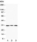 Western blot testing of Apolipoprotein D antibody and Lane 1: MCF-7; 2: HeLa; 3: SMMC-7721 cell lysate. Predicted molecular weight: ~21/21-33kDa (unmodified/glycosylated).