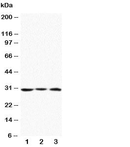 Western blot testing of Apolipoprotein D antibody and Lane 1: MCF-7; 2: HeLa; 3: SMMC-7721 cell lysate. Predicted molecular weight: ~21/21-33kDa (unmodified/glycosylated).