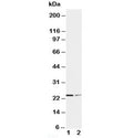 Western blot testing of SOCS1 antibody and Lane 1: HT1080; 2: COLO320 cell lysate. Predicted molecular weight ~ 24 kDa.