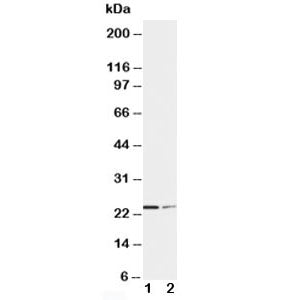 Western blot testing of SOCS1 antibody and Lane 1: HT1080; 2: COLO320 cell lysate. Predicted molecular weight ~ 24 kDa.