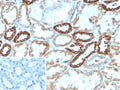 IHC staining of FFPE human kidney tissue with PLA2R1 antibody (clone PLA2R1/4891). Inset: PBS used in place of primary Ab (secondary Ab negative control). HIER: boil tissue sections in pH 9 10mM Tris with 1mM EDTA for 20 min and allow to cool before testing.
