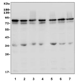 Western blot testing of human 1) U-87 MG, 2) HeLa, 3) MDA-MB-453, 4) PC-3, 5) A431, 6) Caco-2 and 7) HepG2 cell lysate with LYRIC antibody. Expected molecular weight: 70-80 kDa.