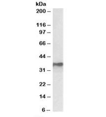 Western blot testing of MCF7 lysate with HNRNPA2B1 antibody at 0.3ug/ml. Predicted molecular weight: ~36kDa.