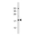 Western blot testing of IL-23 antibody at 1:2000 dilution + mouse pancreas lysate. Predicted molecular weight ~21 kDa, observed molecular weight ~19 kDa.