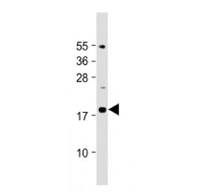 Western blot testing of IL-23 antibody at 1:2000 dilution + mouse pancreas lysate. Predicted molecular weight ~21 kDa, observed molecular weight ~19 kDa.