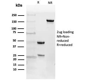 SDS-PAGE analysis of purified, BSA-free EGFR antibody (clone 225) as confirmation of integrity and purity.