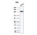Western blot testing of human brain tissue lysate with HK1 antibody (clone HK1/9509). Predicted molecular weight ~120 kDa.