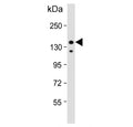 Western blot testing of human HeLa cell lysate with Insulin receptor substrate 2 antibody. Predicted molecular weight ~137 kDa but it may be observed at up to ~190 kDa due to phosphorylation.