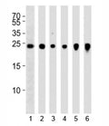 Western blot analysis of lysate from 1) NCI-H460, 2) U266, 3) mouse Neuro-2a, rat 4) PC-12 and 5) C6 cell line and 6) mouse brain tissue using UchL1 antibody at 1:1000. Predicted molecular weight ~25 kDa.