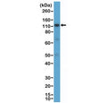 Western blot testing of human K562 cell lysate with recombinant CD30 antibody at 1:1000 dilution. Expected molecular weight: 53-120 kDa depending on glycosylation level.