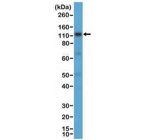 Western blot testing of human K562 cell lysate with recombinant CD30 antibody at 1:1000 dilution. Expected molecular weight: 53-120 kDa depending on glycosylation level.