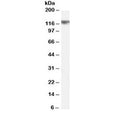 Western blot testing of rat brain lysate with Cyld antibody at 0.5ug/ml. Predicted molecular weight ~107 kDa, observed here at ~125 kDa.