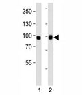 Western blot analysis of lysate from (1) A549 and (2) HeLa cell line using FGFR3 antibody at 1:1000. Predicted molecular weight: 87-135 kDa depending on glycosylation level.