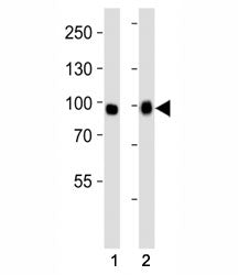 Western blot analysis of lysate from (1) A549 and (2) HeLa cell line using FGFR3 antibody at 1:1000. Predicted molecular weight: 87-135 kDa depending on glycosylation level.