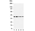 Western blot testing of Angiopoietin 2 antibody and Lane 1: Recombinant human ANGPT2 protein 10ng; 2: 5ng; 3: 2.5ng
