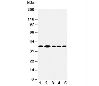 Western blot testing of Angiopoietin 2 antibody and Lane 1: Recombinant human ANGPT2 protein 10ng; 2: 5ng; 3: 2.5ng