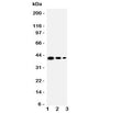 Western blot testing of TRAM2 antbody; Lane 1: Recombinant mouse protein 10ng; 2: 5ng; 3: 2.5ng