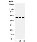 Western blot testing of 1) rat liver, 2) mouse HEPA and 3) human HeLa lysate with ALDH7A1 antibody at 0.5ug/ml. Predicted molecular weight ~58 kDa.