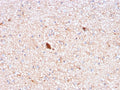 IHC staining of FFPE human brain with Serum Amyloid P antibody (clone APCS/3240). HIER: boil tissue sections in pH 9 10mM Tris with 1mM EDTA for 10-20 min and allow to cool before testing.