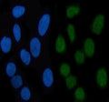 Immunofluorescent staining of FFPE human HeLa cells with Phospho-STAT3 antibody (green) and DAPI nuclear stain (blue). HIER: steam section in pH6 citrate buffer for 20 min.