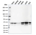 Western blot testing of human samples with MDH1 antibody. Predicted molecular weight: ~36 kDa.