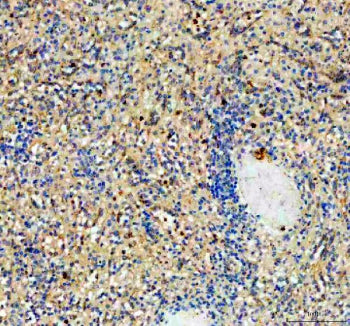 Immunohistochemical staining of NCR3 using anti-NCR3 antibody. NCR3 was detected in a paraffin-embedded section of human spleen tissue. Heat mediated antigen retrieval was performed in EDTA buffer (pH 8.0, epitope retrieval solution). The tissue section was blocked with 10% goat serum. The tissue section was then incubated with 2 ug/ml rabbit anti-NCR3 antibody overnight at 4oC. Peroxidase Conjugated Goat Anti-rabbit IgG was used as secondary antibody and incubated for 30 min at 37oC.