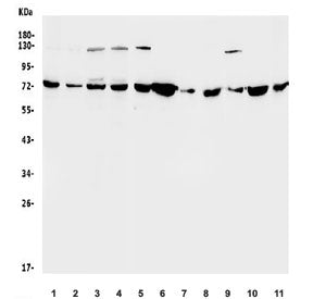 Western blot testing of human 1) HeLa, 2) HepG2, 3) HEK293, 4) Caco-2 and rat 5) brain, 6) kidney, 7) spleen, 8) liver and mouse 9) brain, 10) kidney, 11) liver lysate with SDHA antibody. Predicted molecular weight ~72 kDa.