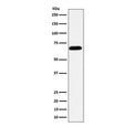 Western blot testing of human HeLa cell lysate with Intestinal Alkaline Phosphatase antibody. Predicted molecular weight: 57-68 kDa depending on glycosylation level.