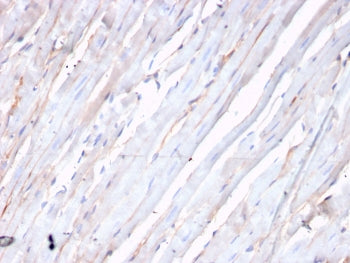 IHC staining of FFPE human heart with recombinant CDH2 antibody. HIER: boil tissue sections in pH 9 10mM Tris with 1mM EDTA for 20 min and allow to cool before testing.