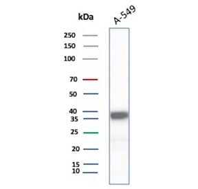Western blot testing of human A549 cell lysate using AKR1C1 antibody (clone AKR1C1/9317). Predicted molecular weight ~37 kDa.