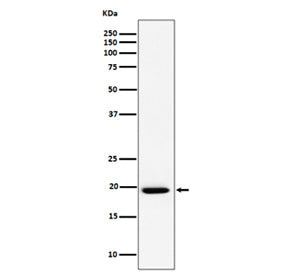 Western blot analysis of UFC1 expression in cell lysate using UFC1 antibody. Predicted molecular weight ~19 kDa.