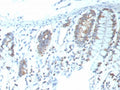 IHC staining of FFPE human colon tissue with recombinant CD151 antibody (clone CD151/9297R). HIER: boil tissue sections in pH 9 10mM Tris with 1mM EDTA for 20 min and allow to cool before testing.