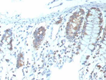 IHC staining of FFPE human colon tissue with recombinant CD151 antibody (clone CD151/9297R). HIER: boil tissue sections in pH 9 10mM Tris with 1mM EDTA for 20 min and allow to cool before testing.