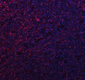Immunofluorescent staining of FFPE human lymphoma tissue with Mitochondrial fission factor antibody (red) and DAPI nuclear stain (blue). HIER: steam section in pH8 EDTA buffer for 20 min.