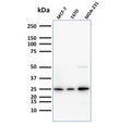 Western blot testing of human samples with Mammaglobin antibody (clone SPM518). Expected molecular weight: 10-21 kDa depending on level of glycosylation.
