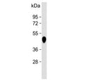 Western blot testing of human pancreas lysate with Carboxypeptidase B antibody. Predicted molecular weight ~45 kDa.